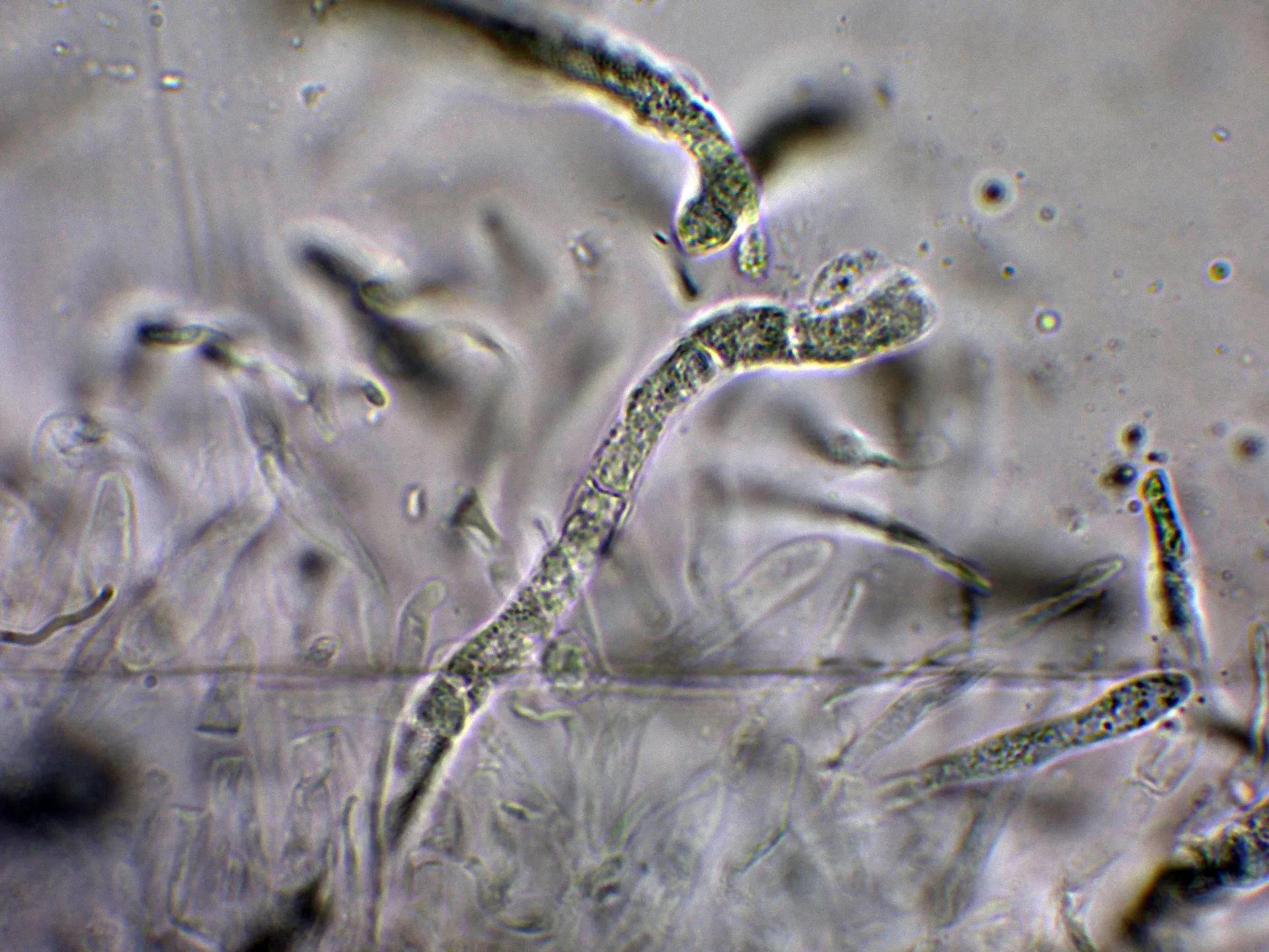 Microscopía de Russula nobilis - 10 - Dermatocistidios SV-005